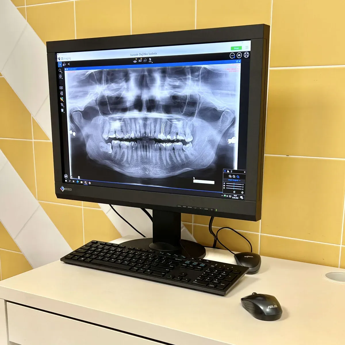 Monitor z cyfrowym pantomograficznym zdjęciem RTG