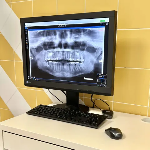 Monitor z cyfrowym pantomograficznym zdjęciem RTG
